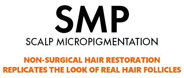 SMP - Scalp Micropigmentation