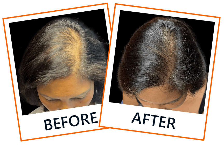 Banda-Photo-Toss-Woman